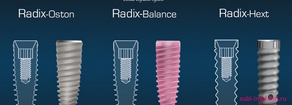 линейка имплантов radix