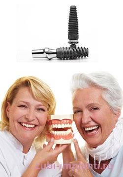возможные варианты имплантации зубов у пожилых пациентов