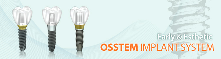 зубные импланты osstem