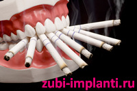 курение и имплантация зубов