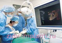 операция по установке зубных имплантов
