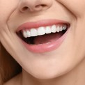 Голливудская улыбка и белоснежные зубы
