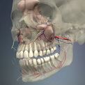 Имплантация при отклонениях зубочелюстной системы